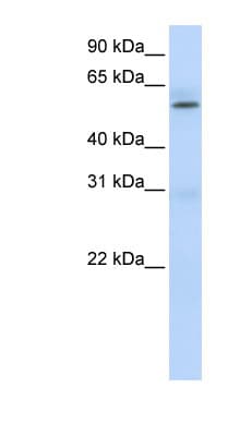 PRMT3 Antibody (aa432-481)