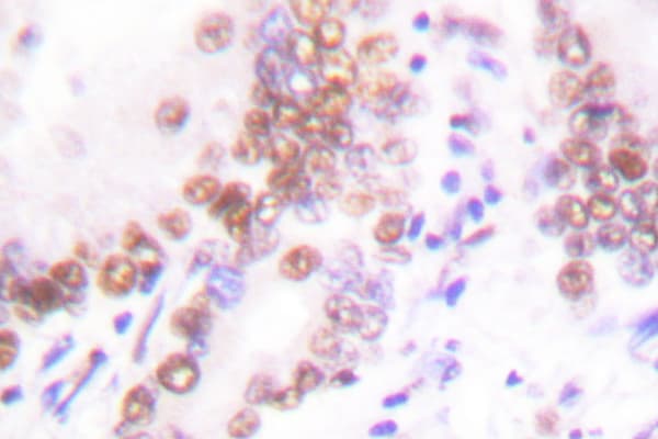 EP300 / p300 Antibody (Val6)