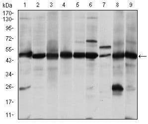 ASS1 / ASS Antibody (clone 2B10)