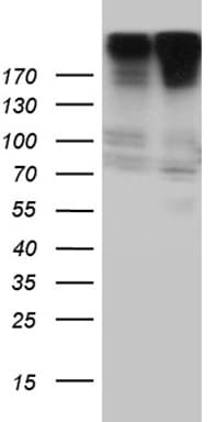 Polyclonal Rabbit anti-Human CAD Antibody (WB)
