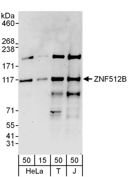 Polyclonal Rabbit anti-Human ZNF512B Antibody (aa650-700, WB)