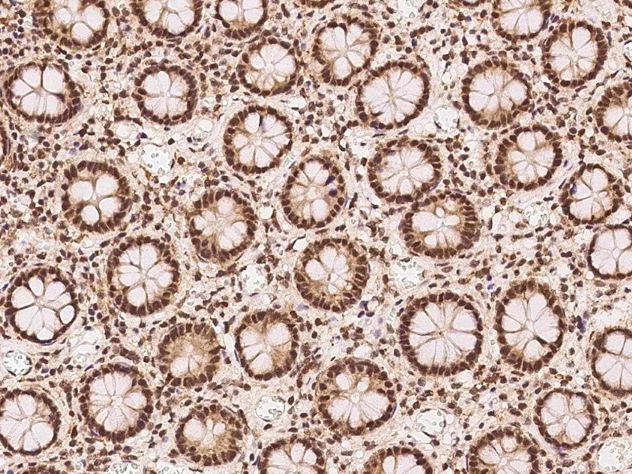 FBXO7 Antibody