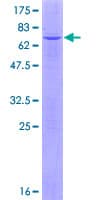 Human PLB1 Protein (Recombinant GST)