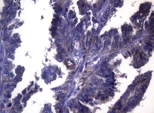 LGALS3 / Galectin 3 Antibody (clone OTI8E3)