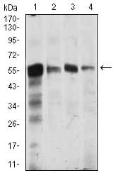 CAMK4 / CaMK IV Antibody (clone 8C5B8)