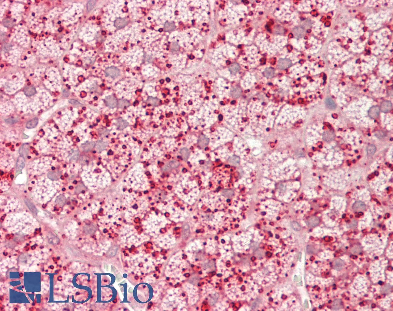 ASAH1 / Acid Ceramidase Antibody (N-Terminus)