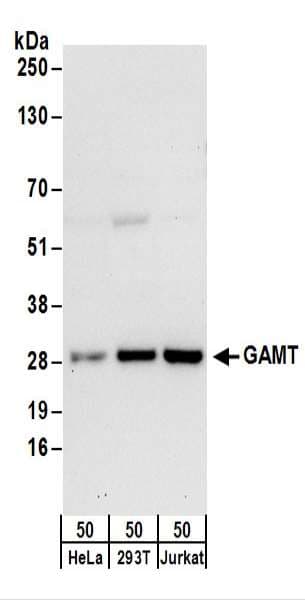Polyclonal Rabbit anti-Human GAMT Antibody (aa1-50, WB)