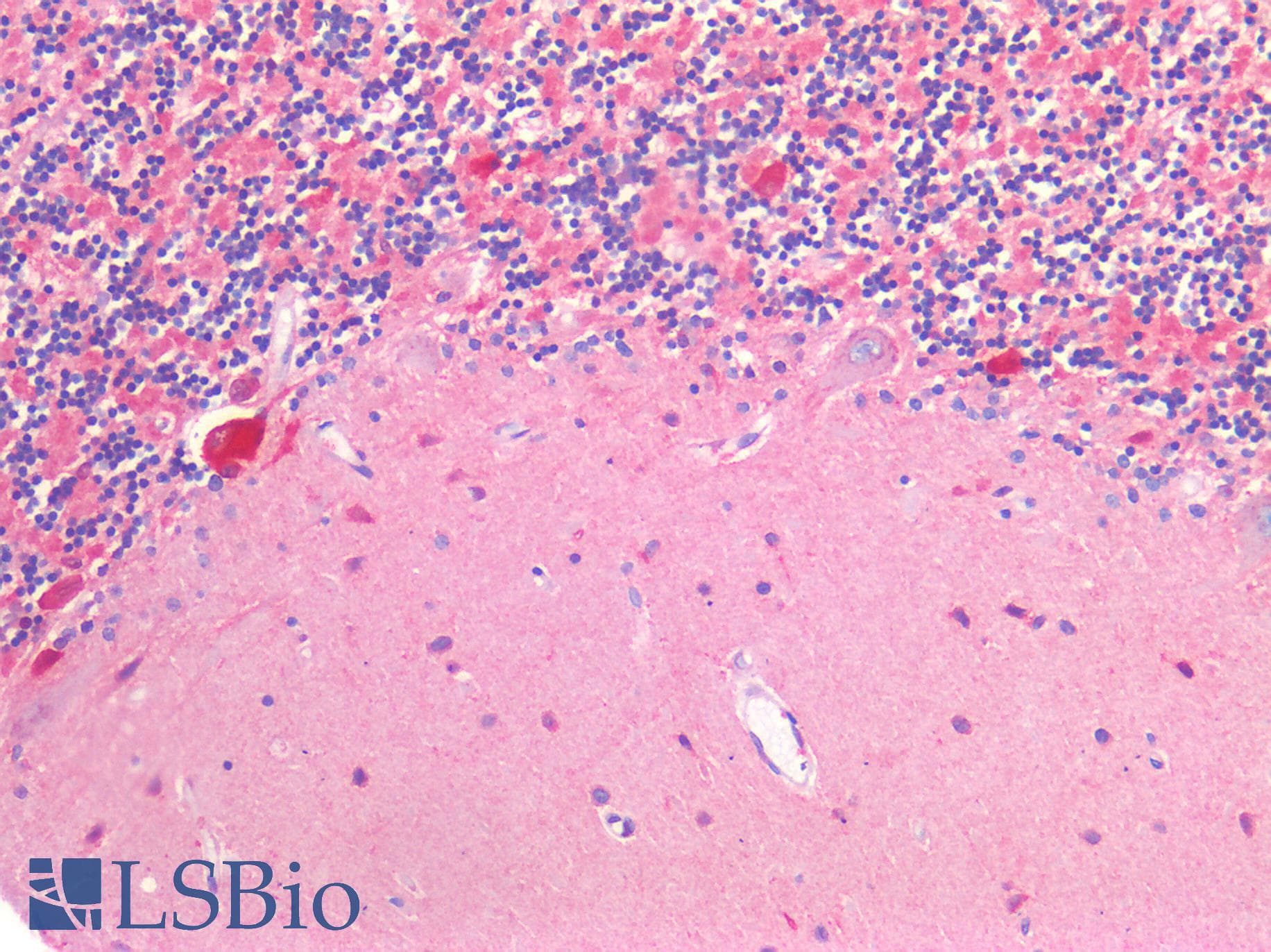 IHC-plus™ SLC17A7 / VGLUT1 Antibody