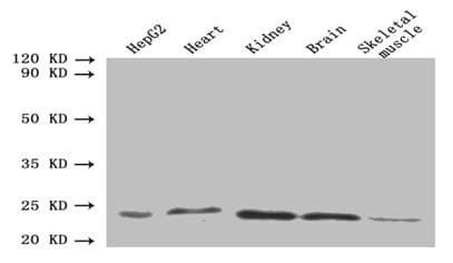 IHC-plus™ ORM2 / Orosomucoid 2 Antibody