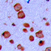 Polyclonal Rabbit anti-Human GAP43 Antibody (N-Terminus, IHC, IF, WB)