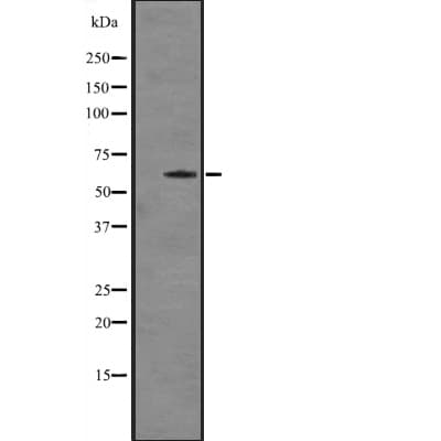 Polyclonal Rabbit anti-Human CYP7A1 Antibody (IHC, WB)