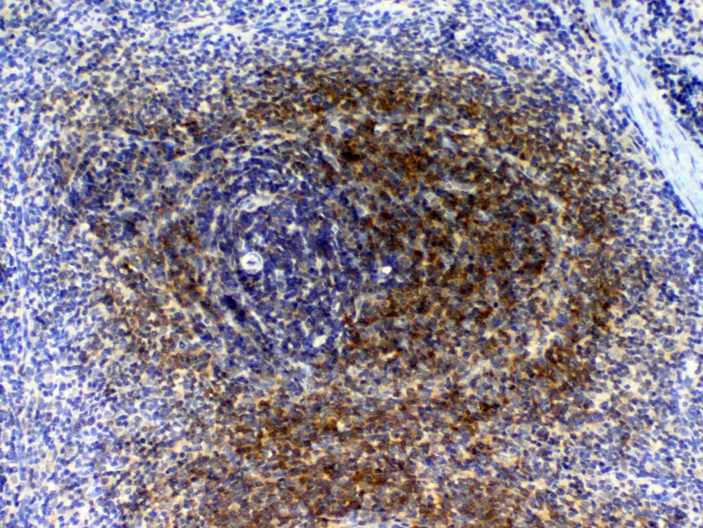 BID Antibody