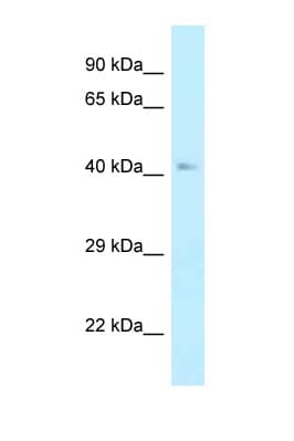 SAHH / AHCY Antibody (aa136-185)