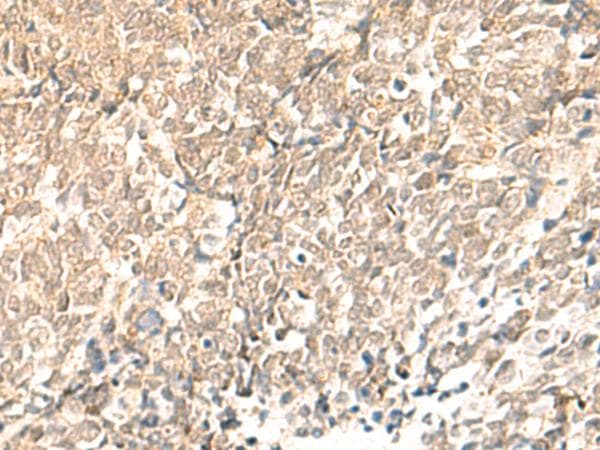 Polyclonal Rabbit anti-Human TBPL1 / TRF2 Antibody (IHC)