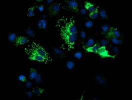 Monoclonal Mouse anti-Human DLD / Diaphorase / E3 Antibody (clone OTI4A10, IHC, IF, WB)