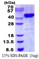 Human CSNK2A2 Protein (Recombinant His)