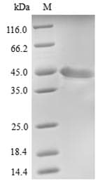 Human FAM46C Protein (Recombinant 6His, N-terminus)