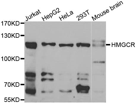 Polyclonal Rabbit anti-Human HMG-CoA Reductase / HMGCR Antibody (IHC, IF, WB)