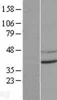 CNTD1 Protein (Over-Expression Lysate Myc-DDK (Flag))
