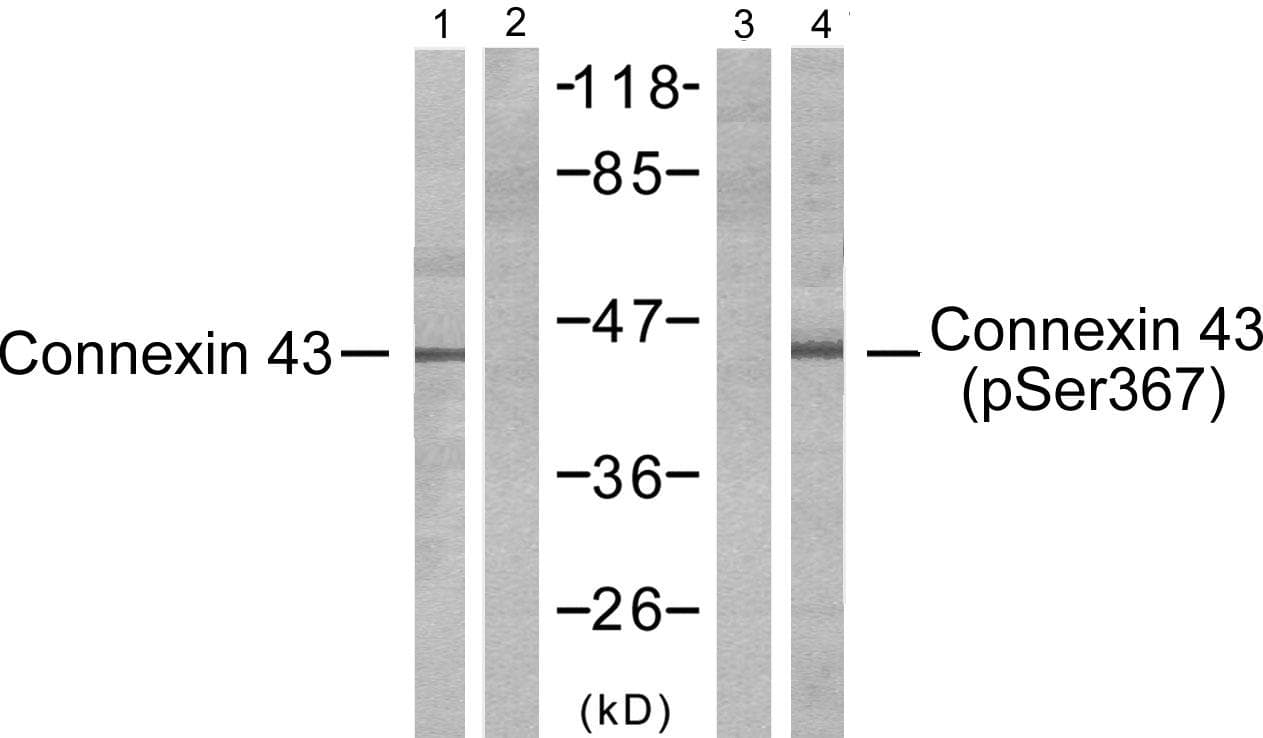 Polyclonal Rabbit anti-Human GJA1 / CX43 / Connexin 43 Antibody (p367, WB)