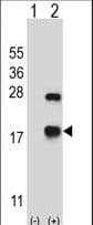 IHC-plus™ CRYAB / Alpha B Crystallin Antibody (aa84-112)