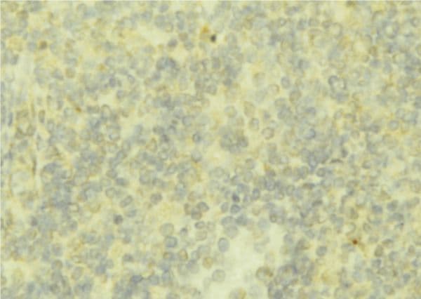 AHSG / Fetuin A Antibody