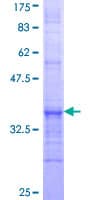 Human ACOX3 Protein (Recombinant GST, N-terminus)
