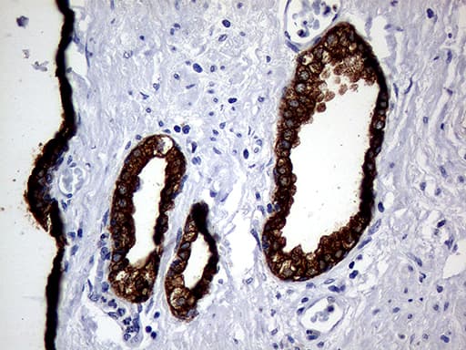 KRT8 / CK8 / Cytokeratin 8 Antibody (aa91-381, clone OTI2F5)