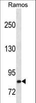 Monoclonal Mouse anti-Human HGF / Hepatocyte Growth Factor Antibody (aa521-554, WB)