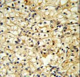 Polyclonal Rabbit anti-Human CD40L Antibody (aa181-207, IHC, WB)