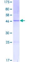 Human BOK Protein (Recombinant GST)