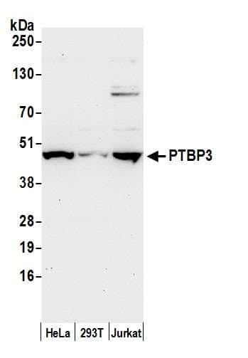 PTBP3 / ROD1 Antibody (aa150-200)