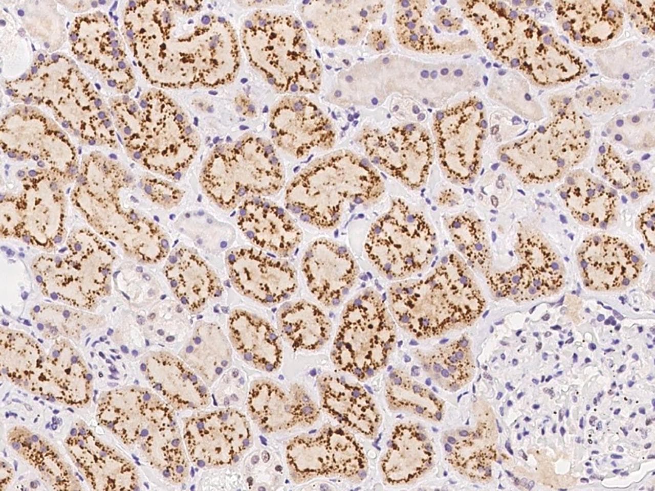 AGXT2 Antibody