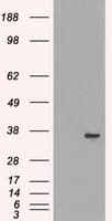 LDHA / LDH1 Antibody (clone OTI2C11)