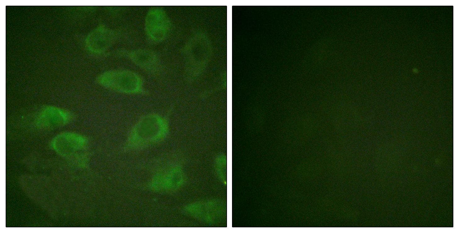 IL2RA / CD25 Antibody (phospho-Ser268)