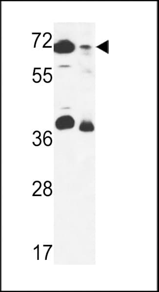 Polyclonal Rabbit anti-Human GSPT2 Antibody (aa216-245, WB)