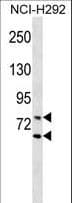 Polyclonal Rabbit anti-Human LMNA / Lamin A+C Antibody (aa401-427, WB)
