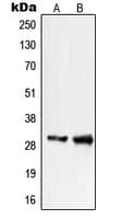 Polyclonal Rabbit anti-Human PIGX Antibody (C-Terminus, WB)