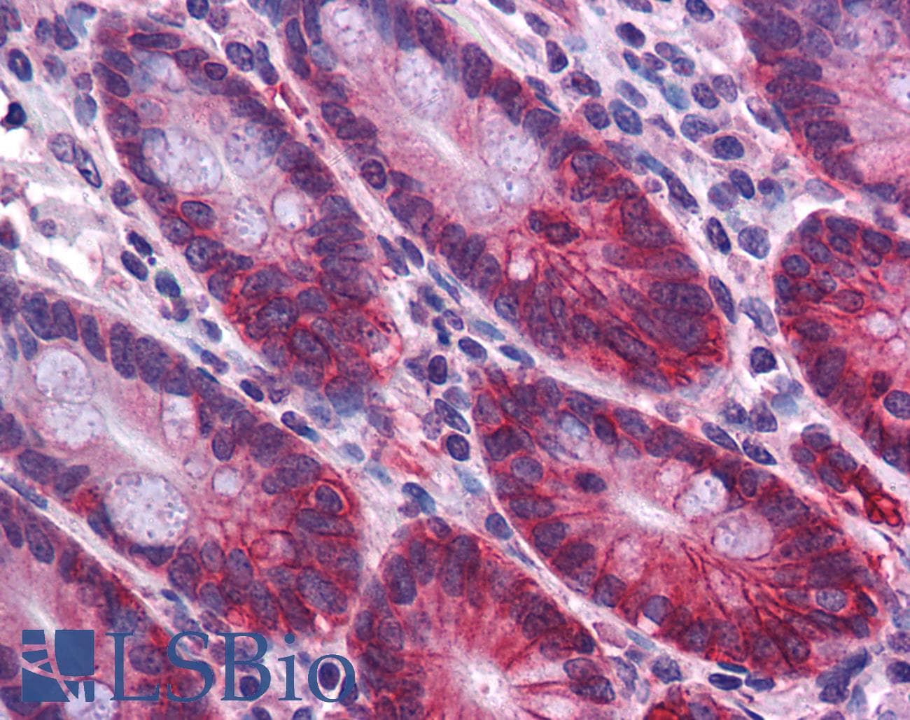 IHC-plus™ Polyclonal Rabbit anti-Human ZBED2 Antibody (IHC, WB)