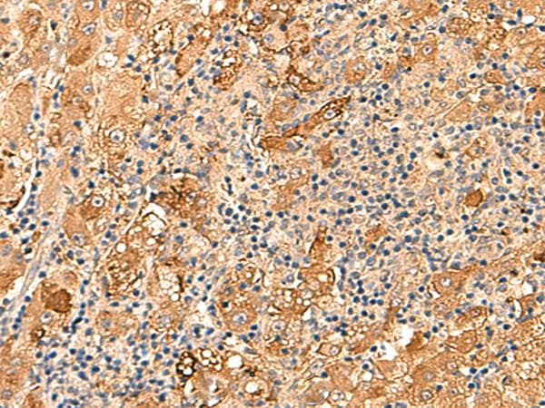 KCNE3 Antibody