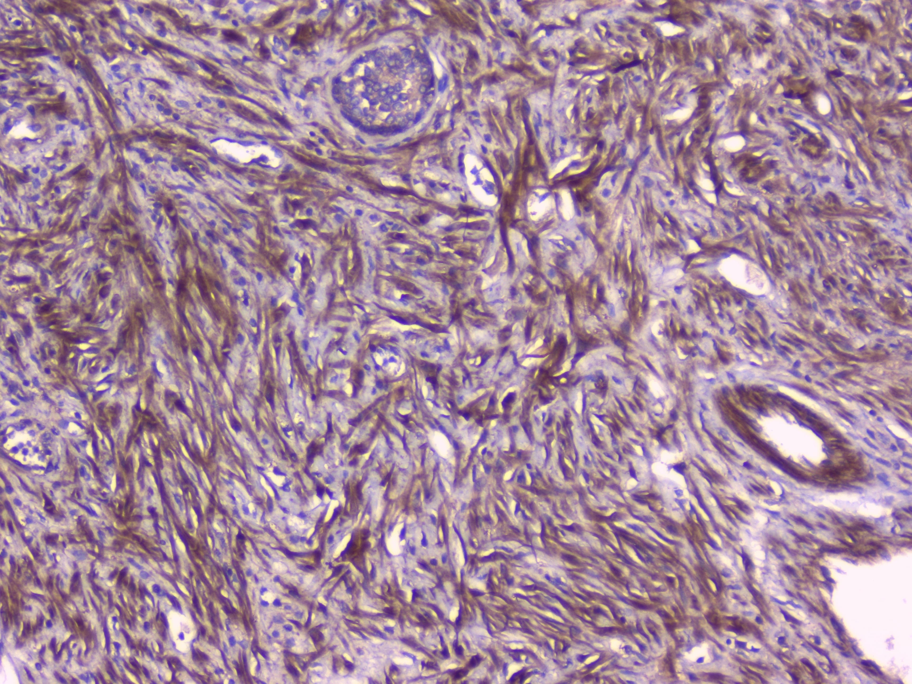 Polyclonal Rabbit anti-Human PEBP1 / RKIP Antibody (WB)