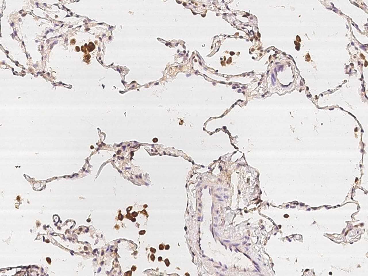 Polyclonal Rabbit anti-Human HEXA Antibody (IHC)