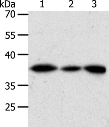 AKR1A1 Antibody