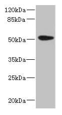 Polyclonal Rabbit anti-Human KRT35 / Keratin 35 / KRTHA5 Antibody (aa1-455, IHC, WB)