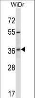 RIBC2 Antibody (aa64-93)