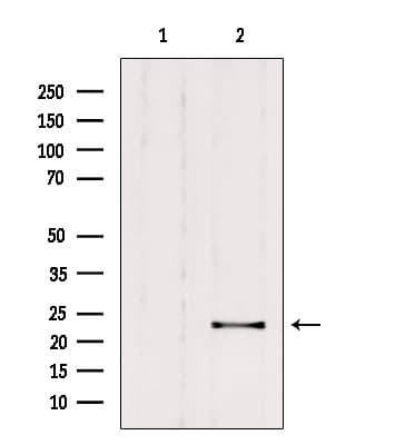 Polyclonal Rabbit anti-Human RAB9B Antibody (WB)