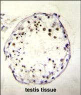 DNAAF3 Antibody (aa 181-210, Internal)