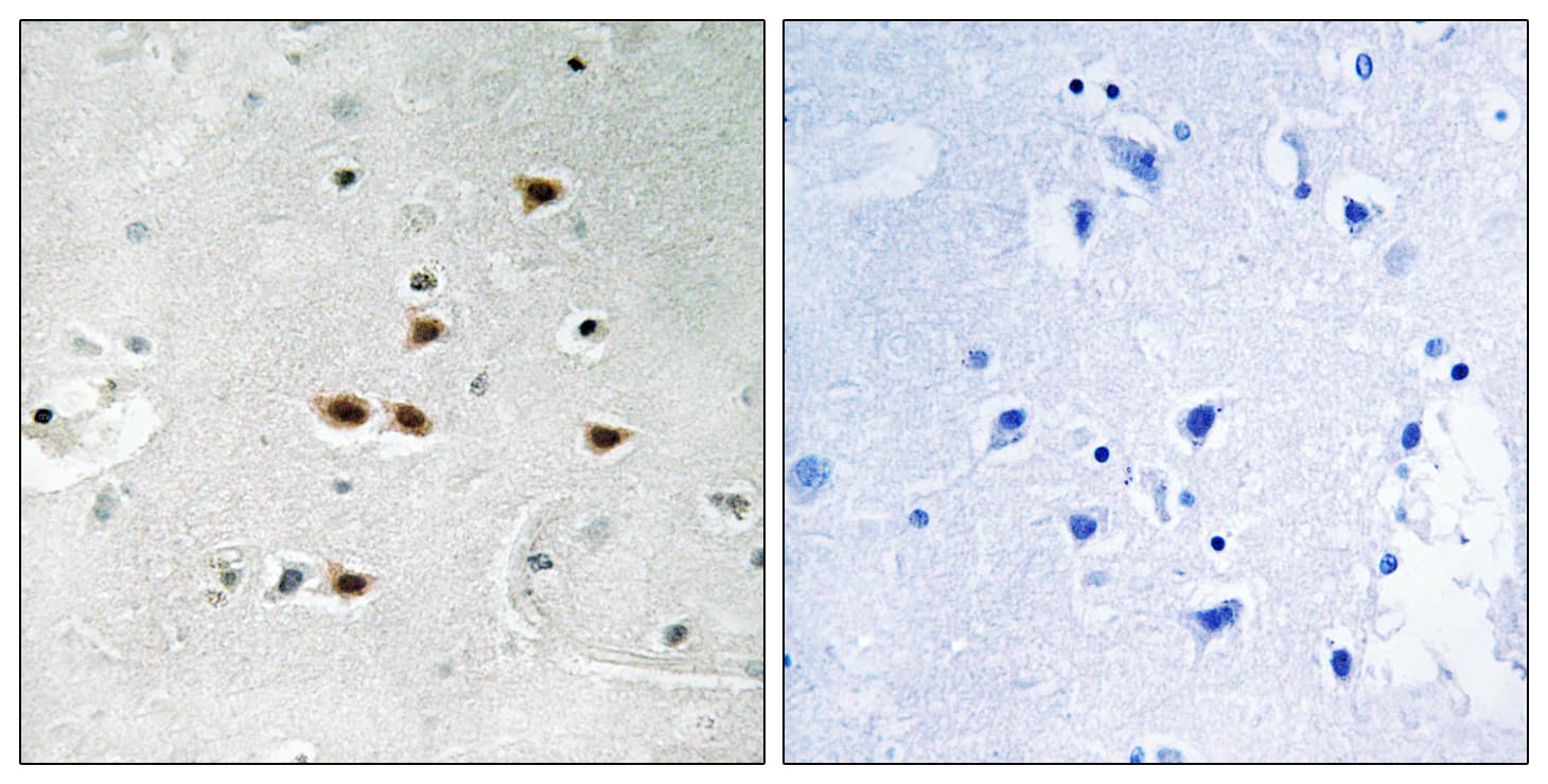 Polyclonal Rabbit anti-Human ITCH / AIP4 Antibody (phospho-Tyr420, IHC)