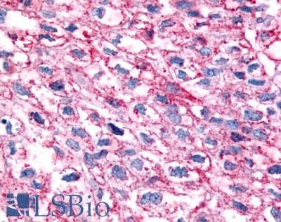 PathPlus™ GPR35 Antibody (C-Terminus)