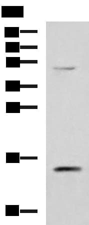 Polyclonal Rabbit anti-Human PHPT1 Antibody (IHC, WB)